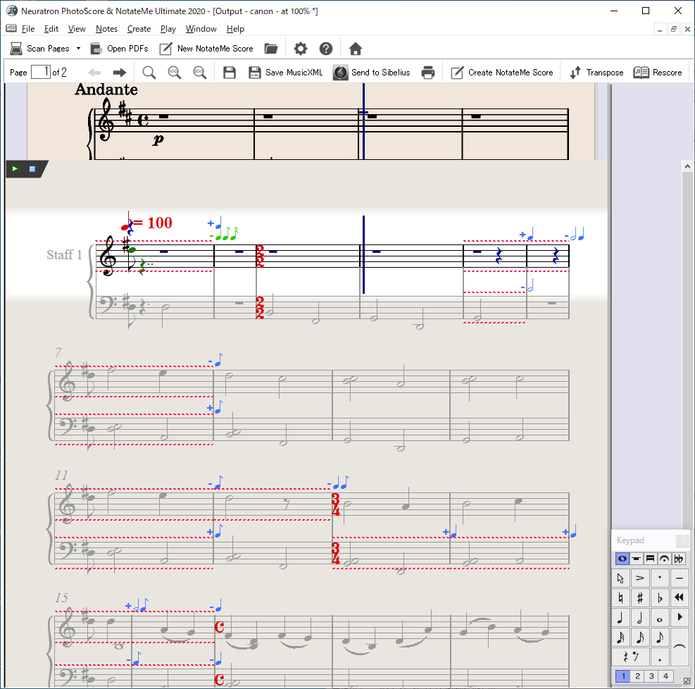 修正予測機能も搭載