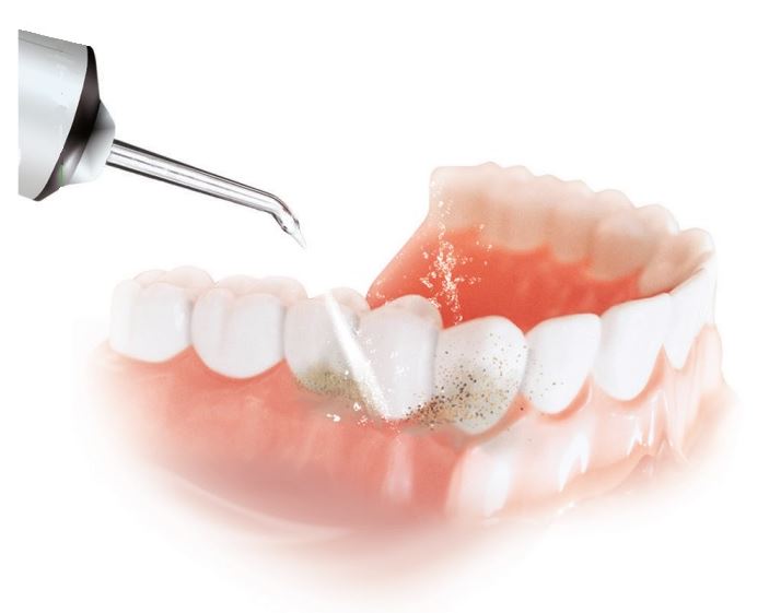 360度回転ヘッド