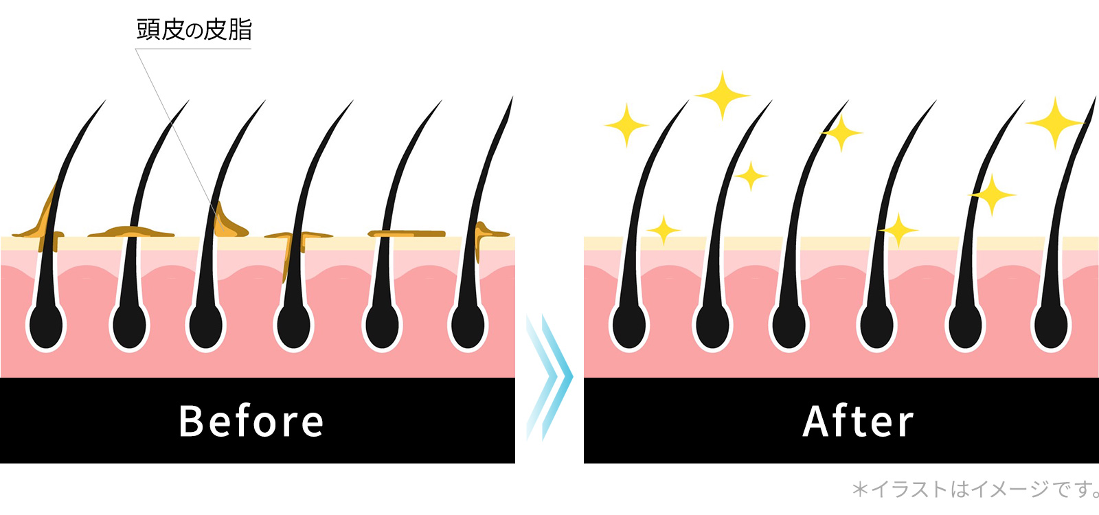 皮脂汚れを除去