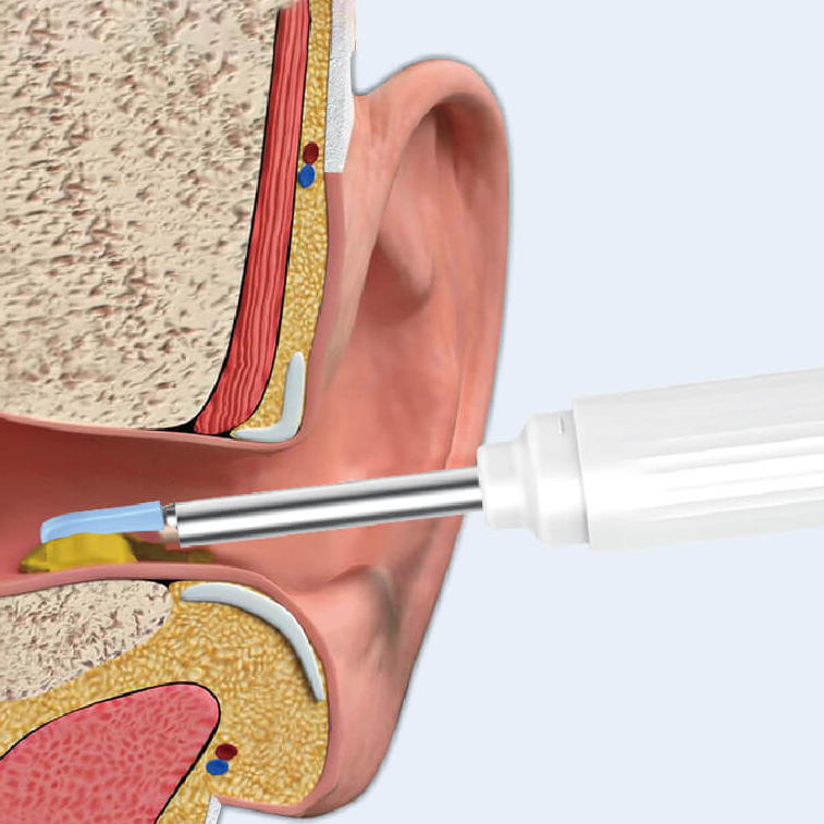 6軸ジャイロスコープ搭載